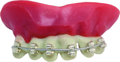 False teeth with bracket