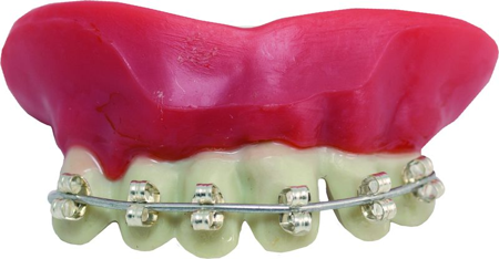 False teeth with bracket