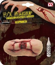 Fracture Ouverte