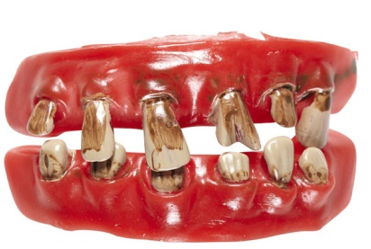 Teeth old ugly teeth